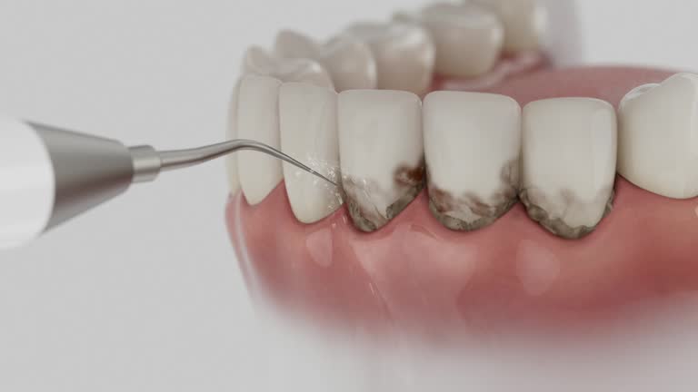 Reliable Dental Implants contractor in Collinsville, TX by Smile Center Dentistry